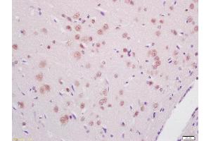 Formalin-fixed and paraffin embedded rat brain tissue labeled with Anti-PKR (Thr446) Polyclonal Antibody, Unconjugated(ABIN744788) 1:200 followed by conjugation to the secondary antibody and DAB staining