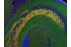 Indirect immunostaining of a PFA fixed mouse hippocampus section with anti-synapsin 3 (dilution1 : 500; red) and guinea pig anti-synapsin 1,2 (cat.