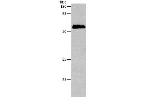 Western Blot analysis of Human cervical cancer tissue using CDC20 Polyclonal Antibody at dilution of 1:600