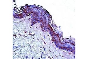 CD1a antibody immunohistochemistry analysis in formalin fixed and paraffin embedded human skin tissue.