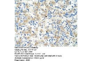 Rabbit Anti-EXOSC6 Antibody  Paraffin Embedded Tissue: Human Liver Cellular Data: Hepatocytes Antibody Concentration: 4. (EXOSC6 anticorps  (N-Term))