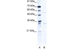 Western Blot showing TRIM17 antibody used at a concentration of 1-2 ug/ml to detect its target protein. (TRIM17 / RNF16 anticorps  (C-Term))