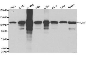 Western blot analysis of extracts of various cell lines using ACTN1 antibody. (ACTN1 anticorps  (AA 1-330))