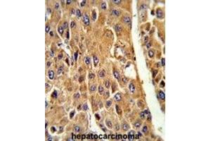 Immunohistochemistry (IHC) image for anti-Cytochrome P450, Family 3, Subfamily A, Polypeptide 5 (CYP3A5) antibody (ABIN3003498)