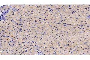 Detection of IkBa in Rat Cardiac Muscle Tissue using Polyclonal Antibody to Inhibitory Subunit Of NF Kappa B Alpha (IkBa)