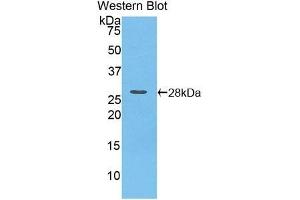 Detection of Recombinant iPLA2, Mouse using Polyclonal Antibody to Phospholipase A2, Calcium Independent (iPLA2) (PLA2G6 anticorps  (AA 481-702))