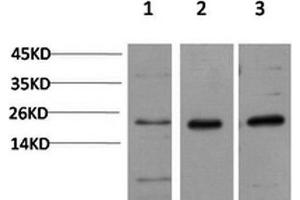 Western Blot analysis of 1) Hela, 2)3T3, 3) PC-12 cells using CBX5 Monoclonal Antibody at dilution of 1:1000. (CBX5 anticorps)