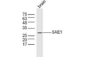 Mouse brain lysates probed with SAE1 Polyclonal Antibody, Unconjugated  at 1:300 dilution and 4˚C overnight incubation. (SAE1 anticorps  (AA 1-100))