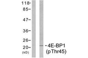 Western blot analysis of extracts from MDA-MB-435 cells treated with EGF 200ng/ml 5', using 4E-BP1 (Phospho-Thr45) Antibody.