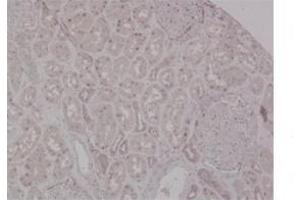 Sample Type:  Human KidneyPrimary   Dilution:  1ug/mL (MSH2 anticorps  (N-Term))
