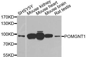 Western blot analysis of extracts of various cell lines, using POMGNT1 antibody. (POMGNT1 anticorps)