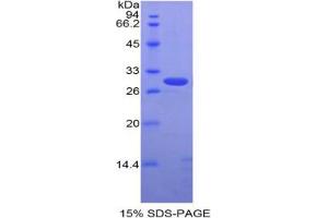 SDS-PAGE analysis of Rabbit ALCAM Protein. (CD166 Protéine)