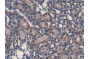 Detection of LPS in Rat Kidney Tissue using Monoclonal Antibody to Lipopolysaccharide (LPS) (Lipopolysaccharides (LPS) anticorps)