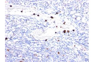 Formalin-fixed, paraffin-embedded human Tonsil stained with Cystatin A Mouse Monoclonal Antibody (CPTC-CSTA-1).