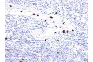 Formalin-fixed, paraffin-embedded human Tonsil stained with Cystatin A Mouse Monoclonal Antibody (CPTC-CSTA-1). (CSTA anticorps)