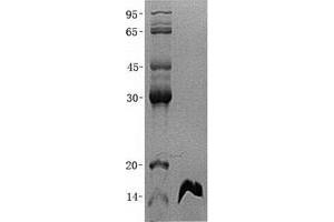Validation with Western Blot (FABP6 Protein (Transcript Variant 1) (His tag))