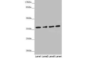 Western blot All lanes: ERLIN2 antibody at 3. (ERLIN2 anticorps  (AA 212-339))