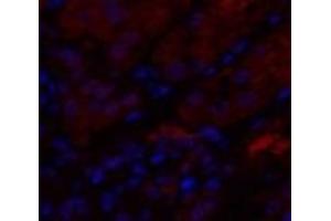 Immunofluorescence analysis of Human kidney tissue using IL8 Polyclonal Antibody at dilution of 1:200. (IL-8 anticorps)