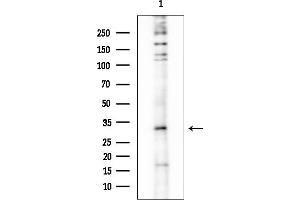 anti-Carbonic Anhydrase XIV (CA14) (Internal Region) antibody