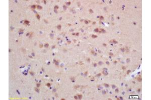 Formalin-fixed and paraffin embedded rat brain labeled with Rabbit Anti CHRNB2 Polyclonal Antibody, Unconjugated (ABIN705836) at 1:200 followed by conjugation to the secondary antibody and DAB staining (CHRNB1 anticorps  (AA 131-230))