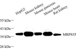 Western blot analysis of MRPS35 (ABIN7074655) at dilution of 1: 500 (MRPS35 anticorps)