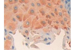 Detection of CCND2 in Human Esophagus Tissue using Polyclonal Antibody to Cyclin D2 (CCND2)