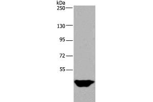 Western Blot analysis of Human testis tissue using MTF2 Polyclonal Antibody at dilution of 1:400 (MTF2 anticorps)