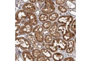 Immunohistochemical staining of human kidney with C6orf108 polyclonal antibody  shows strong cytoplasmic positivity in tubular cells. (RCL anticorps)