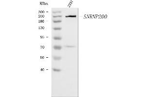 Western blot analysis of SNRNP200 using anti-SNRNP200 antibody (ABIN7602032).
