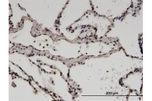 Immunoperoxidase of monoclonal antibody to ZNF192 on formalin-fixed paraffin-embedded human lung.