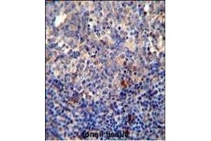 BCL10 antibody (N-term) (ABIN654655 and ABIN2844351) immunohistochemistry analysis in formalin fixed and paraffin embedded human tonsil tissue followed by peroxidase conjugation of the secondary antibody and DAB staining.
