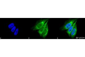 Immunocytochemistry/Immunofluorescence analysis using Rabbit Anti-KDEL Polyclonal Antibody . (KDEL anticorps  (PerCP))