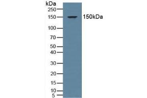 Western blot analysis of Human Blood Cells. (NR3C2 anticorps  (AA 739-984))