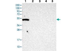 Western blot analysis of Lane 1: RT-4, Lane 2: U-251 MG, Lane 3: human plasma, Lane 4: liver, Lane 5: tonsil GTPBP10 polyclonal antibody .