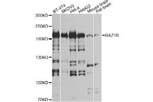 Western blot analysis of extracts of various cell lines, using BAZ1B antibody (ABIN6290092) at 1:1000 dilution.