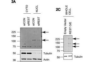 REST antibody - middle region  validated by WB using A549 and HEK293T cells at 1: 500. (REST anticorps  (Middle Region))