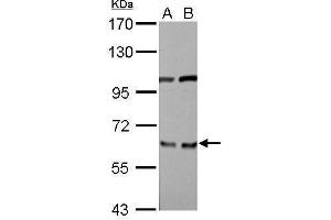 WB Image EIF3D antibody detects EIF3D protein by Western blot analysis.