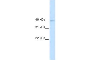 Western Blotting (WB) image for anti-Nudix (Nucleoside Diphosphate Linked Moiety X)-Type Motif 9 (NUDT9) antibody (ABIN2461168) (NUDT9 anticorps)