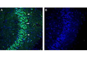 Expression of NHE7 in mouse hippocampus. (Sodium Hydrogen Exchanger 7 (SLC9A7) Peptide)
