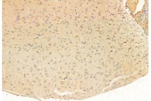 ABIN6265362 and ABIN6272951 at 1/100 staining Rat brain tissue by IHC-P. (SUCLA2 anticorps  (Internal Region))