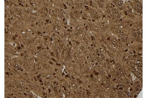 ABIN6277781 at 1/100 staining Rat brain tissue by IHC-P.