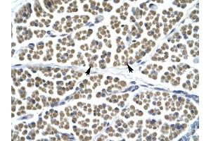 GABRD antibody was used for immunohistochemistry at a concentration of 4-8 ug/ml to stain Skeletal muscle cells (arrows) in Human Muscle.