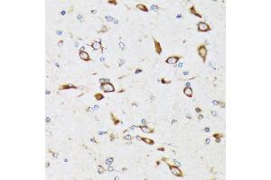 Immunohistochemistry of paraffin-embedded rat brain using RPS20 Rabbit mAb (ABIN7270017) at dilution of 1:100 (40x lens). (RPS20 anticorps)