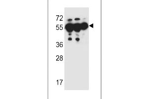 ANKRD57 Antibody (C-term) (ABIN651987 and ABIN2840483) western blot analysis in MDA-M,HepG2,A549 cell line lysates (35 μg/lane). (ANKRD57 anticorps  (C-Term))