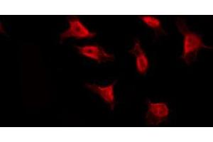 ABIN6274755 staining HepG2 by IF/ICC.