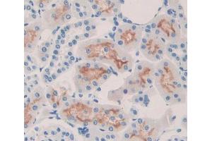IHC-P analysis of kidney tissue, with DAB staining. (ABCC6 anticorps  (AA 1260-1502))