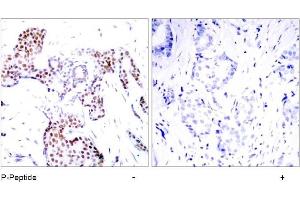 Image no. 1 for anti-ELK1, Member of ETS Oncogene Family (ELK1) (pSer389) antibody (ABIN196678) (ELK1 anticorps  (pSer389))