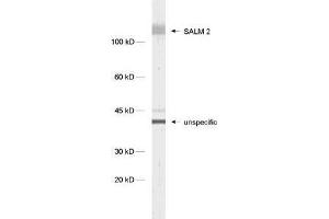 dilution: 1 : 1000, sample: synaptic membrane fraction of rat brain (LP1) (LRFN1 anticorps)