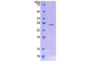 SDS-PAGE (SDS) image for Junctophilin 1 (JPH1) (AA 1-201) protein (His tag) (ABIN6238677) (Junctophilin 1 Protein (JPH1) (AA 1-201) (His tag))