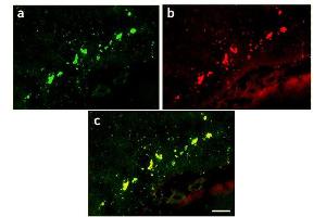 Image no. 1 for anti-Green Fluorescent Protein (GFP) antibody (ABIN346938) (GFP anticorps)